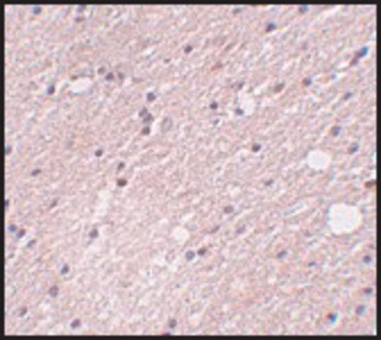 Anti-FRMPD4 antibody produced in rabbit