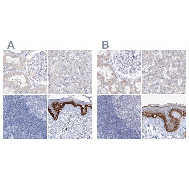 Anti-FRS3 antibody produced in rabbit