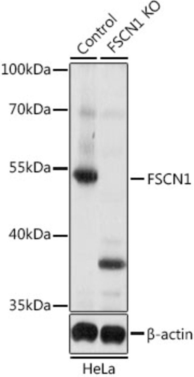 Anti-FSCN1 antibody produced in rabbit