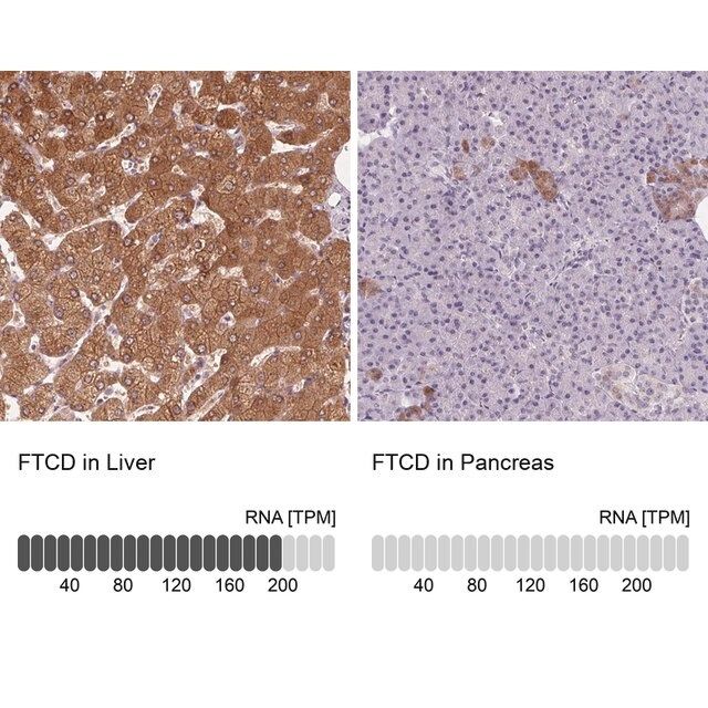 Anti-FTCD antibody produced in rabbit