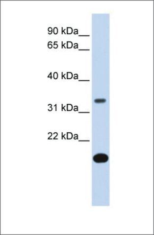 Anti-FST antibody produced in rabbit