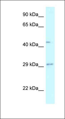 Anti-FUT8 antibody produced in rabbit