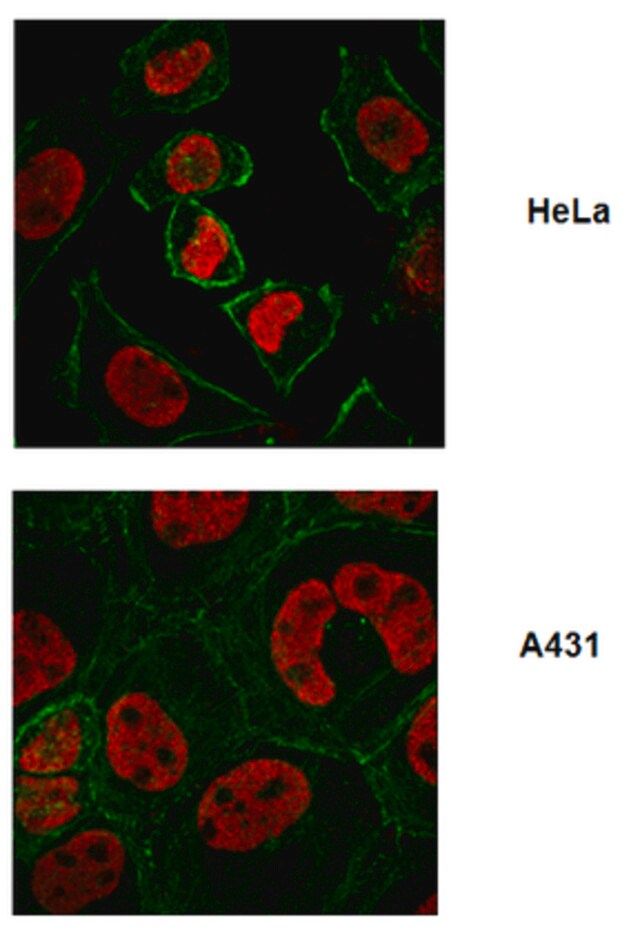 Anti-FUSE-binding protein 1 Antibody