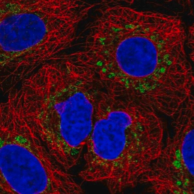 Anti-FXYD2 antibody produced in rabbit