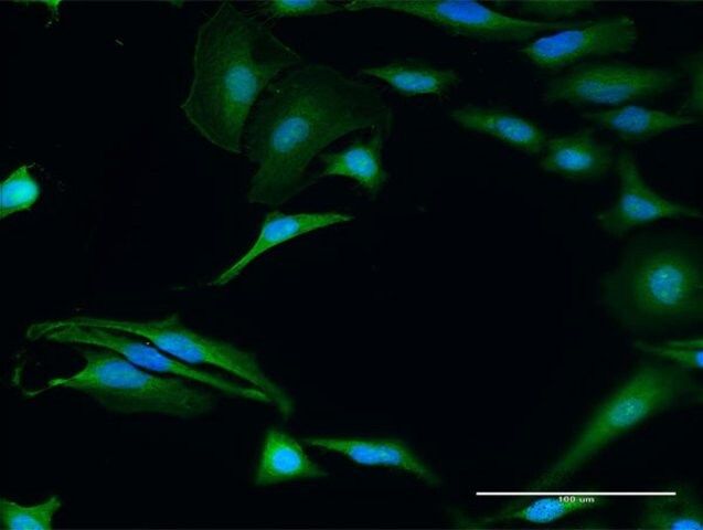 Anti-FXR2 antibody produced in rabbit