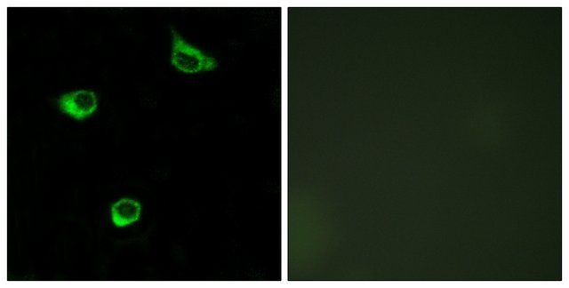 Anti-FZD6 antibody produced in rabbit