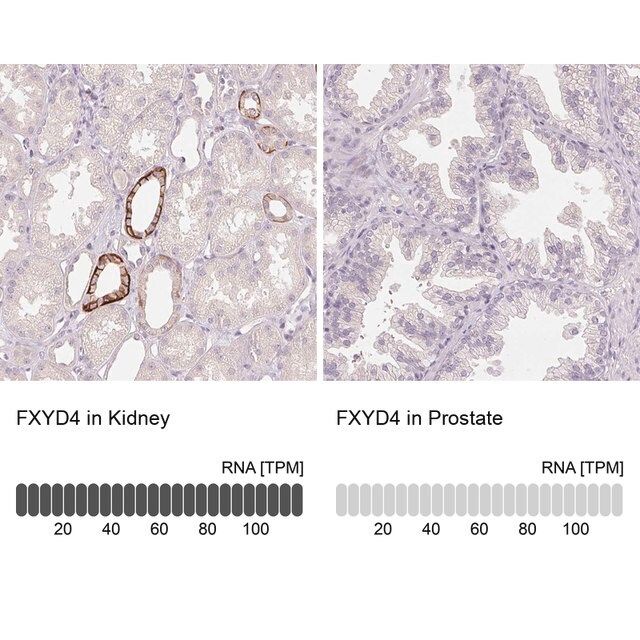 Anti-FXYD4 antibody produced in rabbit