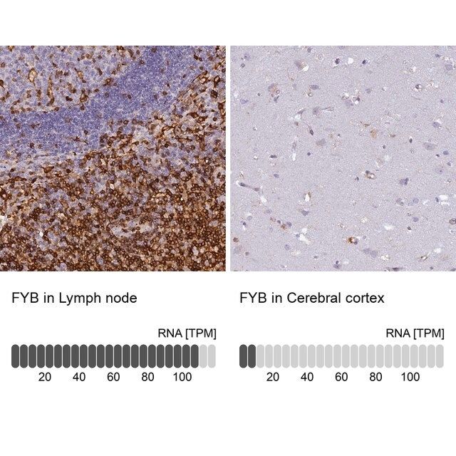 Anti-FYB antibody produced in rabbit