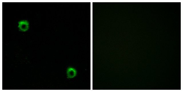 Anti-FZD2 antibody produced in rabbit