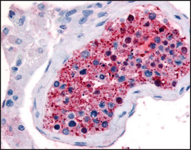 Anti-FZD9 (AB1) antibody produced in rabbit