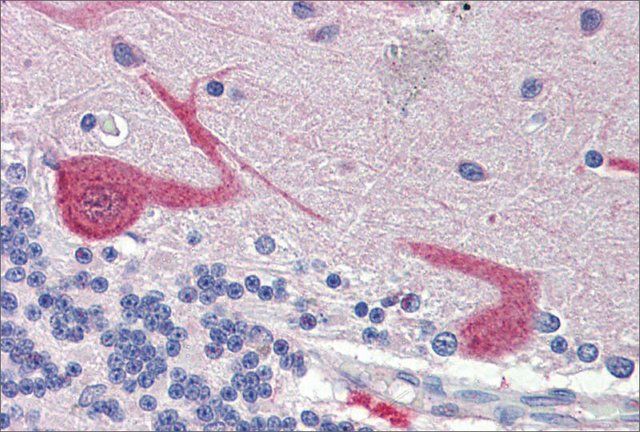 Anti-GABARAPL1, (N-terminal) antibody produced in rabbit