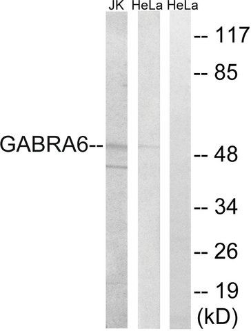 Anti-GABRA6 antibody produced in rabbit