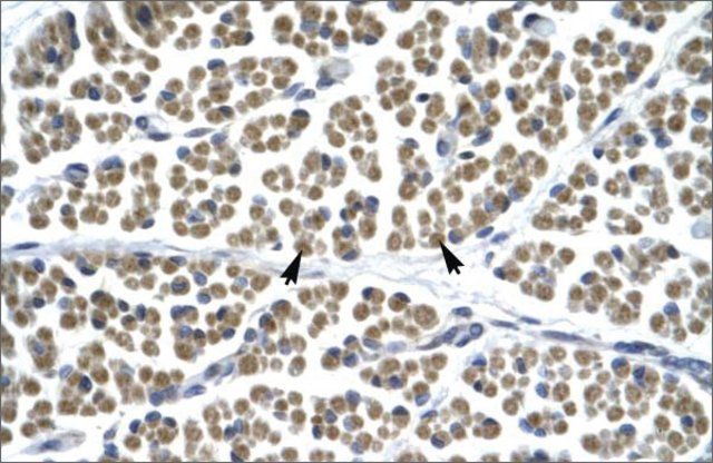 Anti-GABRD antibody produced in rabbit