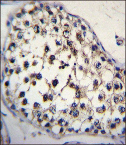 ANTI-FUT8 (CENTER) antibody produced in rabbit