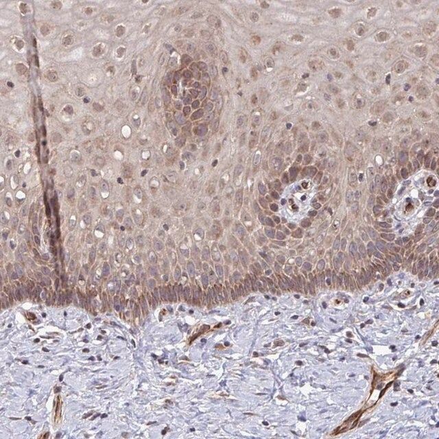 Anti-FUT10 antibody produced in rabbit