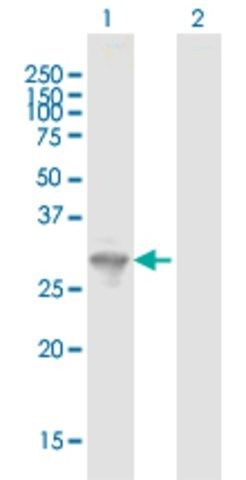 Anti-FYCO1 antibody produced in mouse