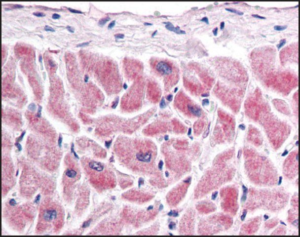 Anti-FZD7 antibody produced in rabbit