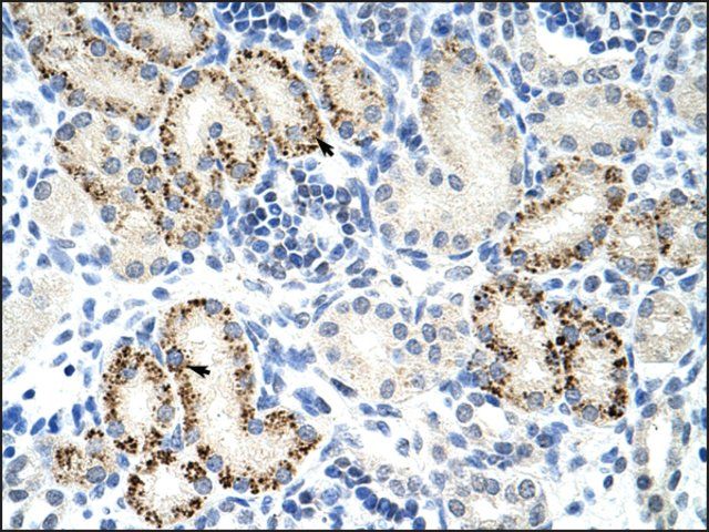 Anti-FZD5 antibody produced in rabbit