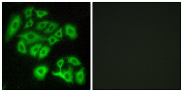 Anti-FZD4 antibody produced in rabbit