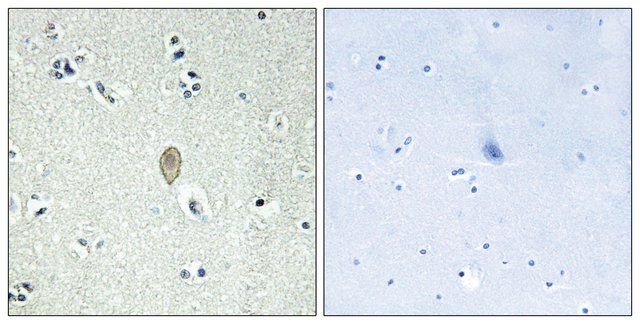 Anti-FZD5 antibody produced in rabbit