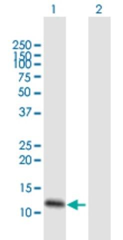 Anti-FXYD3, (C-terminal) antibody produced in mouse