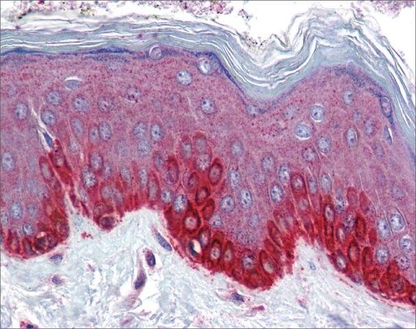 Anti-FZD4 antibody produced in rabbit