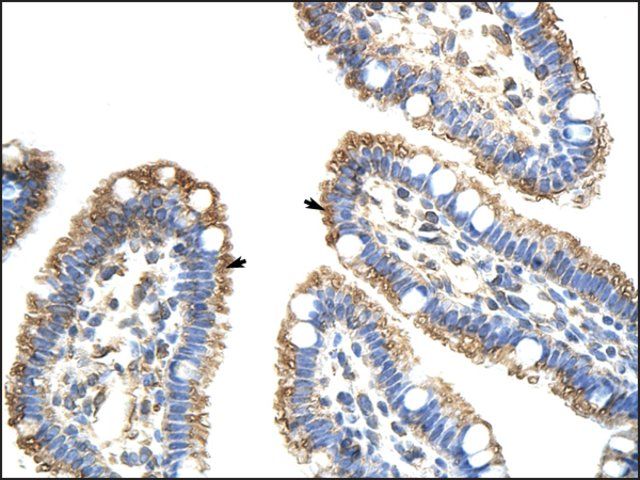 Anti-FZD9 antibody produced in rabbit