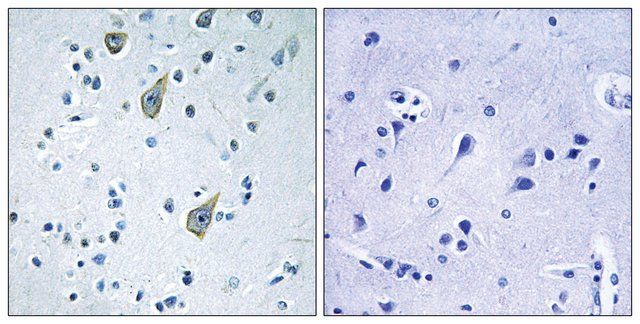 Anti-FZD6 antibody produced in rabbit