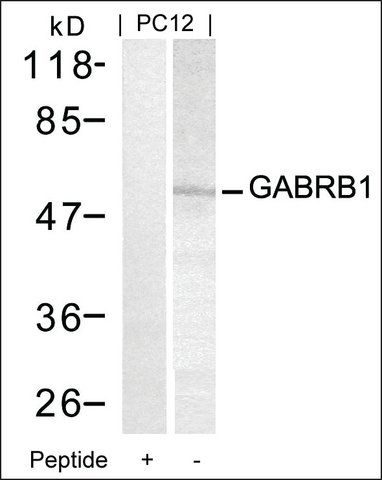 Anti-GABRB1 (Ab-434) antibody produced in rabbit