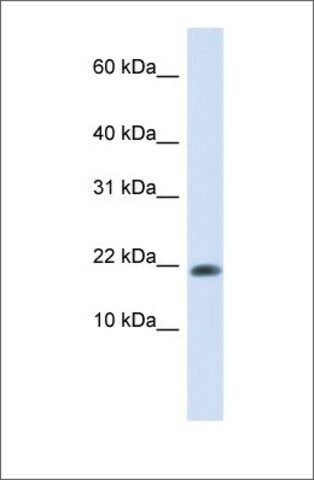 Anti-GABARAPL2