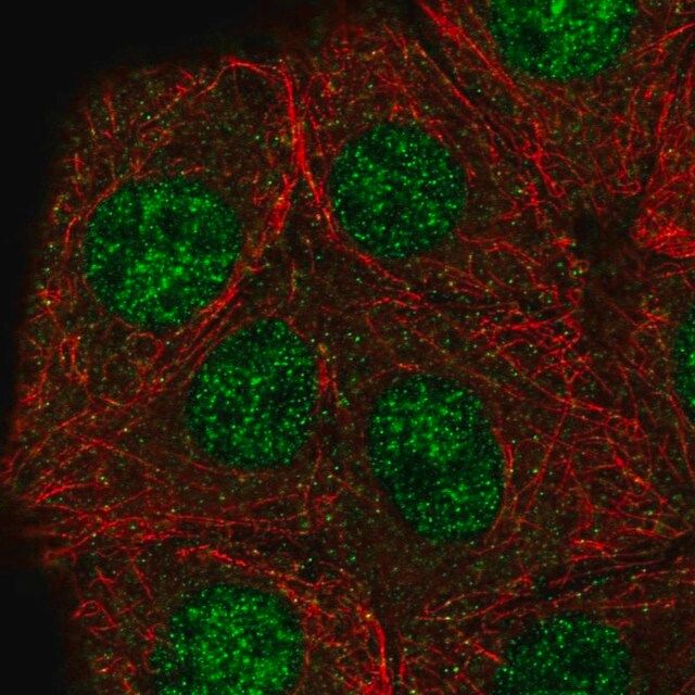 Anti-GABPB2 antibody produced in rabbit