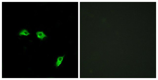 Anti-GABBR1 antibody produced in rabbit