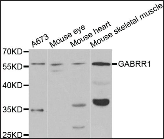 Anti-GABRR1 antibody produced in rabbit