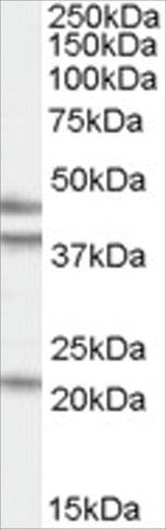 Anti-GABPB2 antibody produced in goat