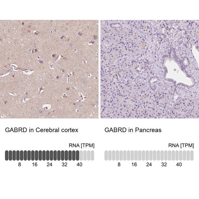 Anti-GABRD antibody produced in rabbit