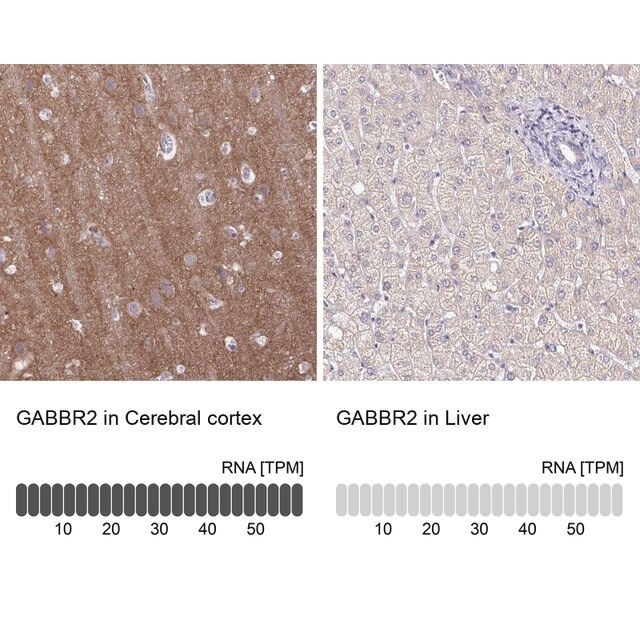 Anti-GABBR2 antibody produced in rabbit