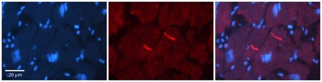 Anti-GABRR2 antibody produced in rabbit