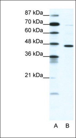 Anti-GABRP antibody produced in rabbit