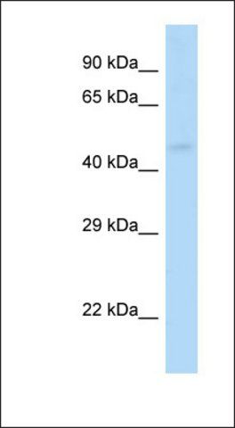 Anti-GABRP antibody produced in rabbit