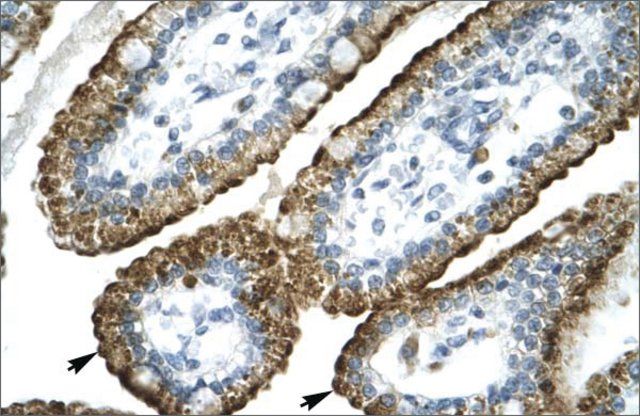 Anti-GABRP antibody produced in rabbit