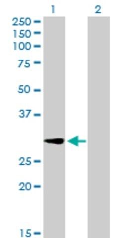 Anti-GALNT12 antibody produced in mouse