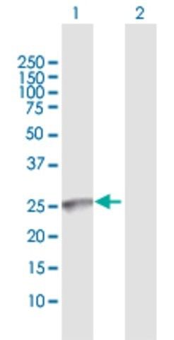 Anti-GALNT9 antibody produced in rabbit