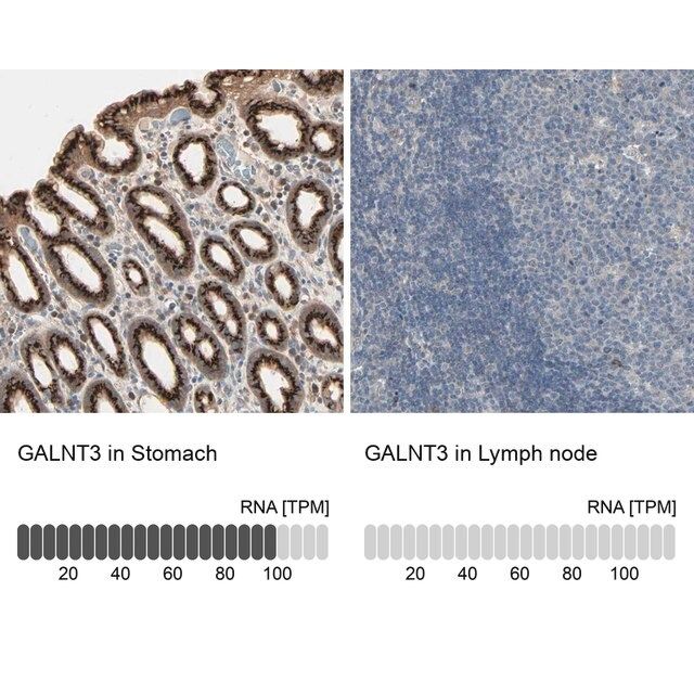 Anti-GALNT3 antibody produced in rabbit