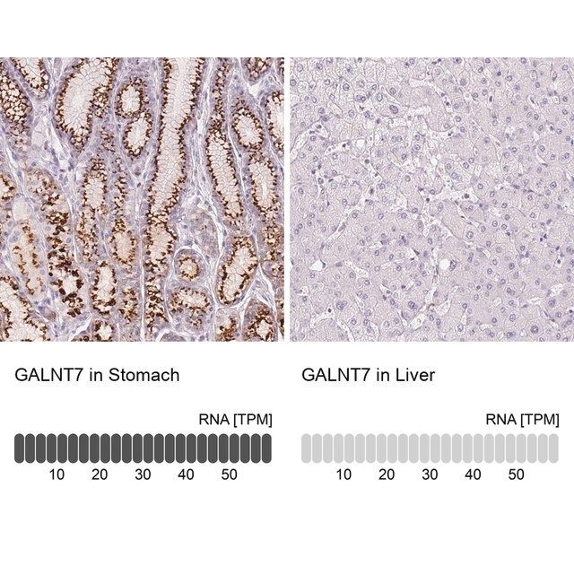 Anti-GALNT7 antibody produced in rabbit