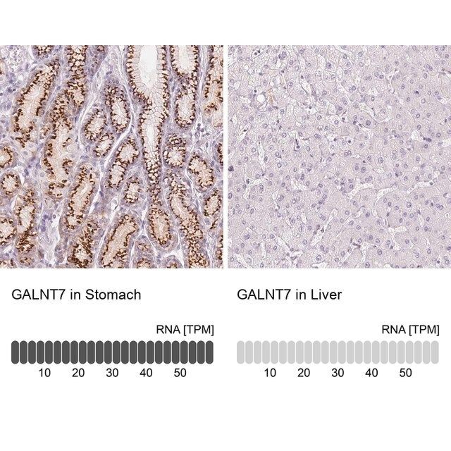 Anti-GALNT7 antibody produced in rabbit