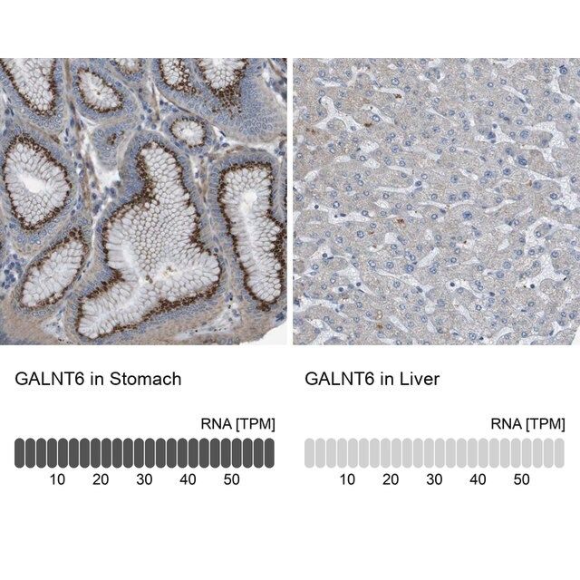 Anti-GALNT6 antibody produced in rabbit