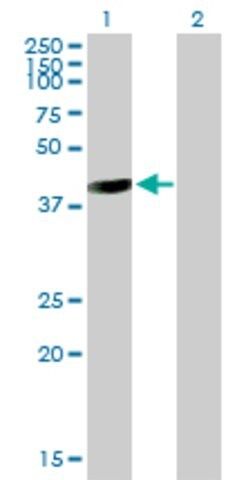 Anti-GALT antibody produced in mouse