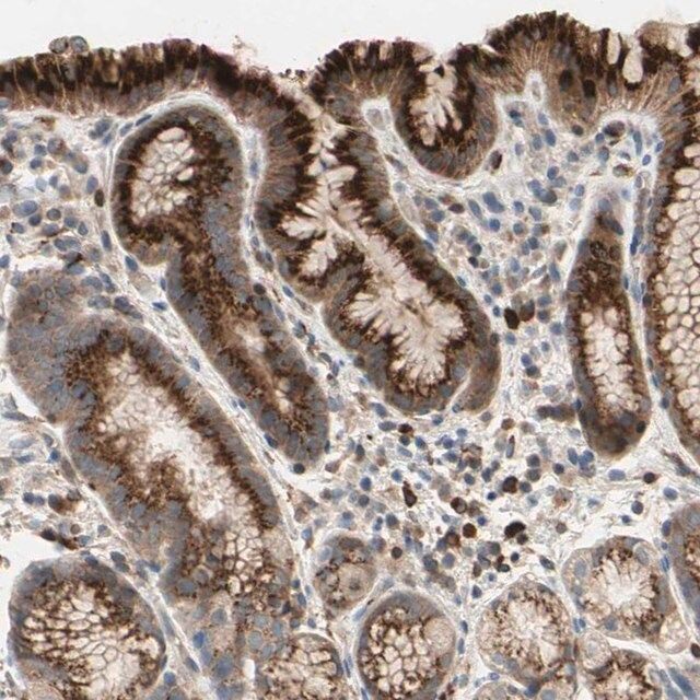 Anti-GALNT5 antibody produced in rabbit