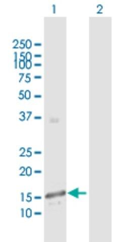 Anti-GALNT3 antibody produced in rabbit