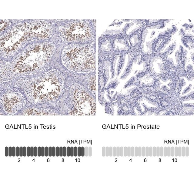 Anti-GALNTL5 antibody produced in rabbit